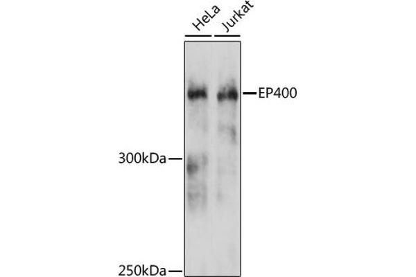 EP400 Antikörper  (AA 90-330)