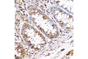 Immunohistochemistry (IHC) image for anti-Pyridoxal (Pyridoxine, Vitamin B6) Phosphatase (PDXP) (C-Term) antibody (ABIN7269758)