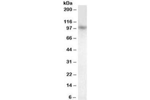 Western blot testing of human cerebellum lysate with PRDM1 antibody at 1ug/ml. (PRDM1 抗体)