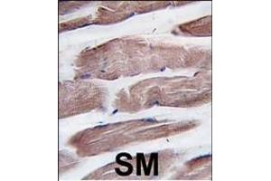 Formalin-fixed and paraffin-embedded human skeletal muscle tissue reacted with hPI3KC3 (N-term) (ABIN1882112 and ABIN2849998) , which was peroxidase-conjugated to the secondary antibody, followed by DAB staining. (PIK3C3 抗体  (N-Term))