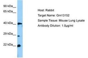 Image no. 1 for anti-Zinc Finger Protein 982 (Zfp982) (N-Term) antibody (ABIN6749822) (Zfp982 抗体  (N-Term))