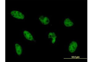 Immunofluorescence of monoclonal antibody to NFYB on HeLa cell. (NFYB 抗体  (AA 1-207))