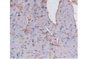 IHC-P analysis of Mouse Heart Tissue, with DAB staining. (Albumin 抗体)