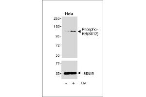 Western blot analysis of lysates from Hela cell line, untreated or treated with UV(2h), using Phospho-RB Antibody (upper) or Tubulin (lower). (Retinoblastoma 1 抗体  (pSer612))