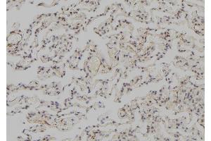 Immunohistochemistry (IHC) image for anti-Small Nuclear RNA Activating Complex, Polypeptide 3, 50kDa (SNAPC3) (C-Term) antibody (ABIN6258328)