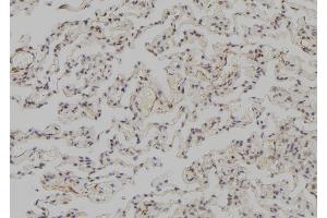 ABIN6273570 at 1/100 staining Human lung tissue by IHC-P. (SNAPC3 抗体  (C-Term))