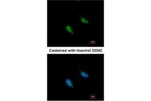ICC/IF Image Immunofluorescence analysis of paraformaldehyde-fixed HeLa, using RFC3, antibody at 1:200 dilution. (RFC3 抗体)