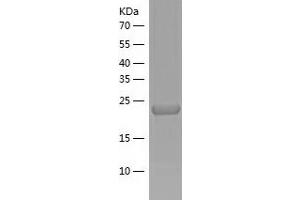 Nuclear Receptor Interacting Protein 3 (NRIP3) (AA 1-241) protein (His-IF2DI Tag)