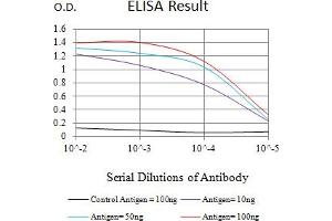 Black line: Control Antigen (100 ng),Purple line: Antigen (10 ng), Blue line: Antigen (50 ng), Red line:Antigen (100 ng) (RRM1 抗体  (AA 541-792))