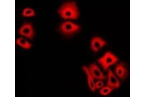 Immunofluorescent analysis of NCS1 staining in A549 cells. (NCS1 抗体)