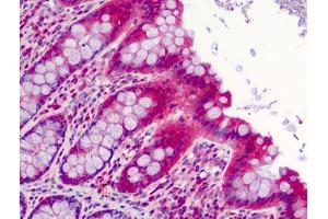 Human Colon: Formalin-Fixed, Paraffin-Embedded (FFPE) (SLFN12 抗体  (C-Term))