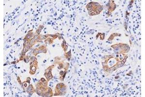 Immunohistochemistry (IHC) image for anti-Fas (TNFRSF6)-Associated Via Death Domain (FADD) (AA 1-208), (N-Term) antibody (ABIN317514) (FADD 抗体  (N-Term))