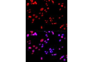 Immunofluorescence analysis of GFP-RNF168 transgenic U2OS cells using RPA2 antibody (ABIN5971215). (RPA2 抗体)