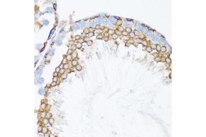 Immunohistochemistry (Paraffin-embedded Sections) (IHC (p)) image for anti-Catenin (Cadherin-Associated Protein), alpha 1, 102kDa (CTNNA1) (AA 637-906) antibody (ABIN6139202)
