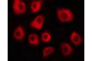 ABIN6267417 staining HepG2 cells by ICC/IF. (Vinculin 抗体  (pTyr822))