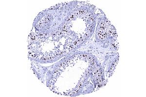 Testis Strong SOX9 staining of Sertoli cells (Recombinant SOX9 抗体  (AA 393-508))
