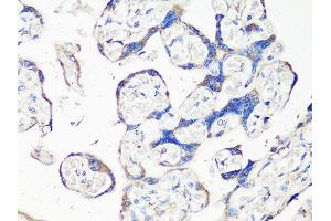Immunohistochemistry of paraffin-embedded human placenta using MMP2 Antibody (ABIN4904395) at dilution of 1:100 (40x lens). (MMP2 抗体)
