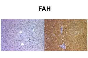 Sample Type: Human Liver and Mouse FAH KO liverPrimary Dilution: 1:400 (FAH 抗体  (C-Term))