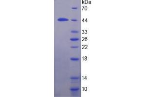 SDS-PAGE analysis of Human TBP Protein. (TBP 蛋白)