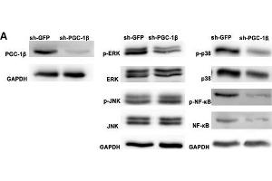 Peroxisome proliferator-activated receptor-gamma coactivator-1 β (PGC-1β) knockdown attenuates proinflammatory cytokines, matrix metalloproteinases (MMPs) and receptor activator of nuclear factor-kappa B ligand (RANKL) production in rheumatoid arthritis (RA)-fibrolast-like synoviocytes (FLS). (PPARGC1B 抗体  (AA 901-1023))