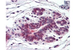 Anti-ELOVL5 antibody IHC of human breast. (ELOVL5 抗体  (Internal Region))