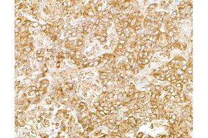 Immunohistochemistry (IHC) image for anti-Ribosomal Protein L7 (RPL7) (C-Term) antibody (ABIN7453643)