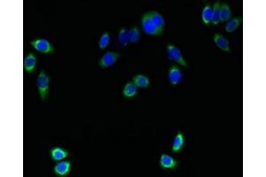 Immunofluorescent analysis of PC-3 cells using ABIN7173083 at dilution of 1:100 and Alexa Fluor 488-congugated AffiniPure Goat Anti-Rabbit IgG(H+L) (TMEM161A 抗体  (AA 29-98))