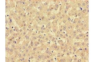 Immunohistochemistry of paraffin-embedded human liver tissue using ABIN7158760 at dilution of 1:100 (LPCAT3 抗体  (AA 306-363))