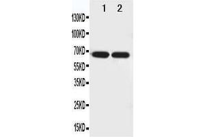 Anti-Netrin 1 antibody, Western blotting Lane 1: U87 Cell Lysate Lane 2: COLO320 Cell Lysate (Netrin 1 抗体  (N-Term))
