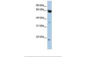 Image no. 1 for anti-Homeobox and Leucine Zipper Encoding (HOMEZ) (AA 72-121) antibody (ABIN6738394) (HOMEZ 抗体  (AA 72-121))