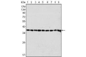 Western Blot showing GAPDH antibody used against Hela (1), A549 (2), A431 (3), MCF-7 (4), K562 (5), Jurkat (6), HL60 (7), SKN-SH (8) and SKBR-3 (9) cell lysate. (GAPDH 抗体)