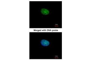 ICC/IF Image Immunofluorescence analysis of paraformaldehyde-fixed HeLa, using RBP-Jkappa, antibody at 1:100 dilution. (RBPJ 抗体)
