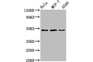Western Blot Positive WB detected in: Hela whole cell lysate, MCF-7 whole cell lysate, A549 whole cell lysate All lanes: LCOR antibody at 4. (Lcor 抗体  (AA 13-144))