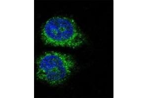 Confocal immunofluorescent analysis of NURR1 antibody with HeLa cells followed by Alexa Fluor 488-conjugated goat anti-rabbit lgG (green).