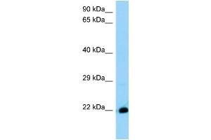 WB Suggested Anti-4930572J05Rik Antibody Titration: 1. (THEM6 抗体  (C-Term))