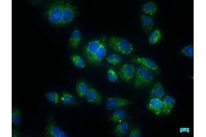 Immunofluorescence staining of Hela cells with ABIN7146911 at 1:50, counter-stained with DAPI. (CARD16 抗体  (AA 1-197))