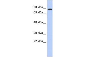 WB Suggested Anti-ZFYVE20 Antibody Titration:  0. (Rabenosyn 5 抗体  (N-Term))