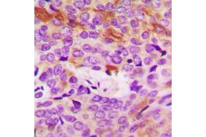 Immunohistochemistry (IHC) image for anti-Collagen, Type IV, alpha 5 (COL4A5) (N-Term) antibody (ABIN7299170)