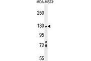ZSWIM6 Antibody (C-term) western blot analysis in MDA-MB231 cell line lysates (35 µg/lane). (ZSWIM6 抗体  (C-Term))