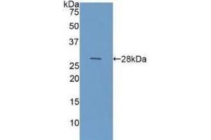 Detection of Recombinant GAL3, Human using Polyclonal Antibody to Galectin 3 (GAL3) (Galectin 3 抗体  (AA 1-250))