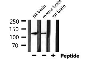 Western blot analysis of extracts from rat brain, mouse brain, using HDAC5 Antibody. (HDAC5 抗体  (C-Term))