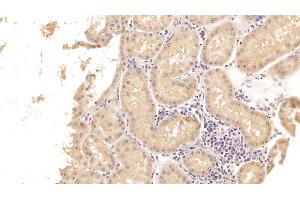 Immunohistochemistry (IHC) image for anti-Sex Hormone Binding Globulin (SHBG) (AA 224-388) antibody (ABIN7425833)