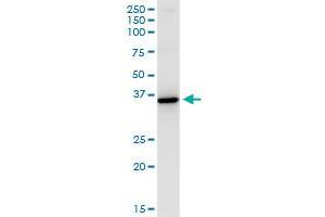 HSD11B1 monoclonal antibody (M02A), clone 2C10. (HSD11B1 抗体  (AA 1-292))