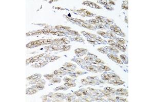 Immunohistochemistry of paraffin-embedded mouse stomach using IER3 antibody (ABIN6134174, ABIN6142158, ABIN6142159 and ABIN6224665) at dilution of 1:100 (40x lens). (IER3 抗体  (C-Term))