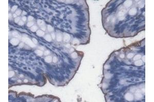 Detection of LPS in Rat Colon Tissue using Monoclonal Antibody to Lipopolysaccharide (LPS) (Lipopolysaccharides (LPS) 抗体)