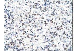 Image no. 1 for anti-Ferrochelatase (FECH) (AA 51-100) antibody (ABIN6736623) (FECH 抗体  (AA 51-100))