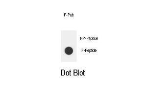 Dot blot analysis of Phospho-ERBB2- Phospho-specific Pab (ABIN1881304 and ABIN2850444) on nitrocellulose membrane. (ErbB2/Her2 抗体  (pTyr1112))