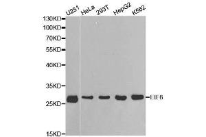Western blot analysis of extracts of various cell lines, using EIF6 antibody. (EIF6 抗体  (AA 1-245))