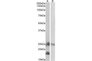 AP22426PU-N DCTN3 antibody staining of Mouse (A) and Rat (B) Skeletal Muscle lysates at 0. (DCTN3 抗体  (Internal Region))