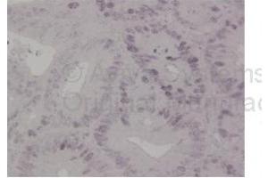 Immunohistochemistry (IHC) image for anti-MutS Homolog 6 (E. Coli) (MSH6) (N-Term) antibody (ABIN2776759)